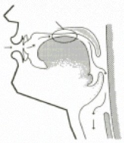 Figura 2